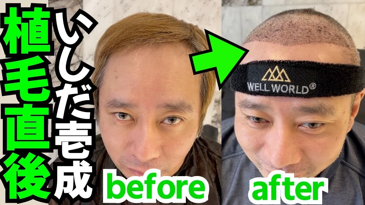 いしだ壱成の現在の仕事と収入!歴代の嫁と子供は何人?若い頃の画像はハゲじゃない?