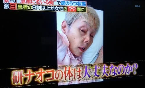 研ナオコの現在は病気でうつ病?子供は息子と娘で結婚してる?若い頃の画像が美人!