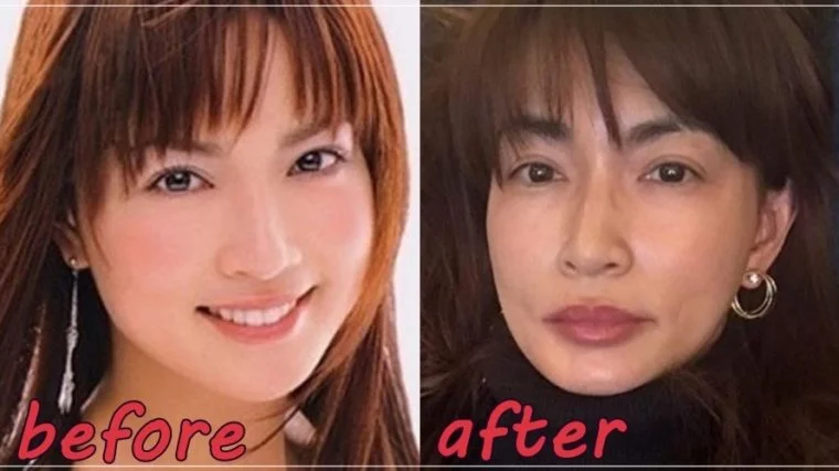 長谷川京子が旦那と離婚した理由はパパ活?子供の親権はどっち?唇が若い頃から変化?