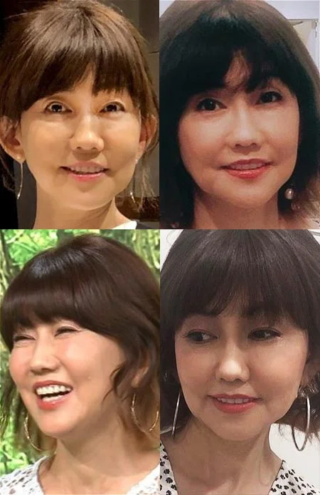 松本伊代はヒアルロン酸入れすぎで顔が変?若い頃の画像がかわいい!線路問題で逮捕?