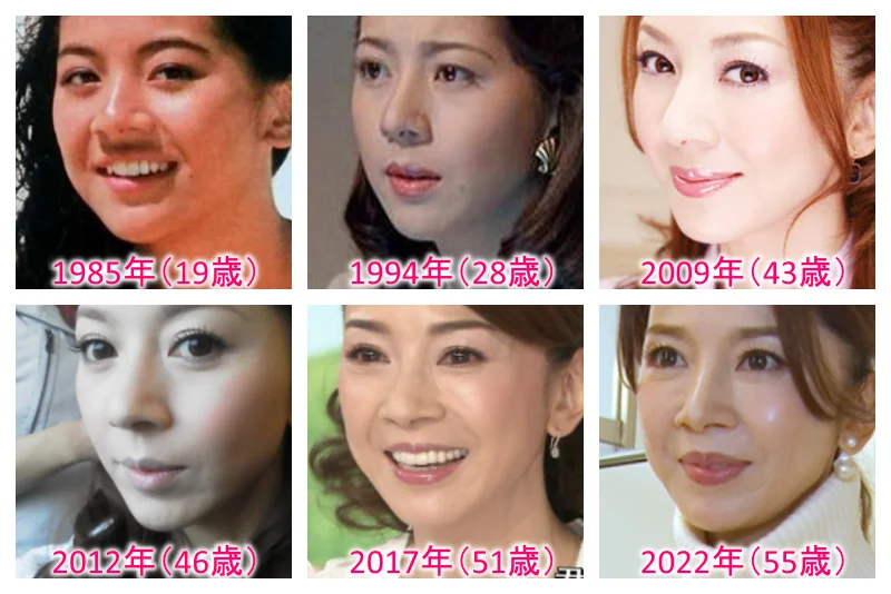 君島十和子は顔が変わって鼻の穴がでかい?子供は娘で長女と次女?旦那に婚外子がいる?