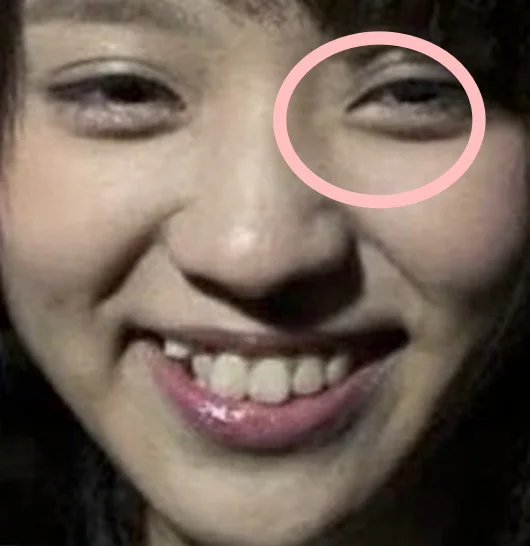 小林由依は目頭切開で顔が変わった?渡邉理佐との関係は不仲?西野七瀬と似てる?