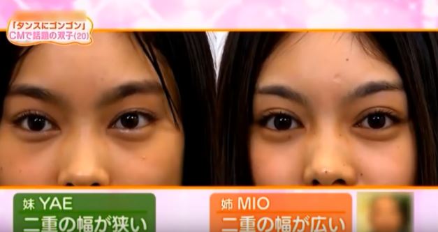 MIOとYAEは双子でハーフで国籍はどこ？痩せすぎで気持ち悪い？目は整形で顔でかい？
