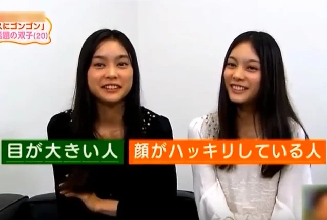 MIOとYAEは双子でハーフで国籍はどこ?痩せすぎで気持ち悪い?目は整形で顔でかい?